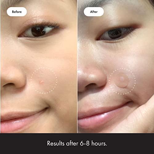 Getting Glossy⁢ Skin: Our Experience with Mighty ‍Patch™