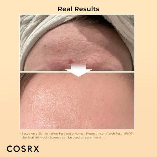 Unlock Radiant Skin with COSRX Snail ‍Mucin Essence: Our Review