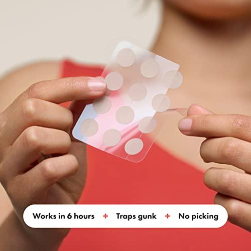 Testing Mighty‌ Patch™: ⁣Our Journey to​ Clearer Skin Overnight