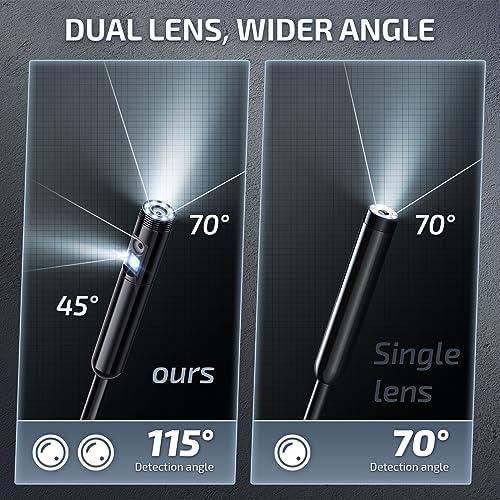 Thorough Review of the Elecshion endoscope camera: insights and Performance